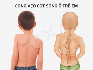 cong-veo-cot-song