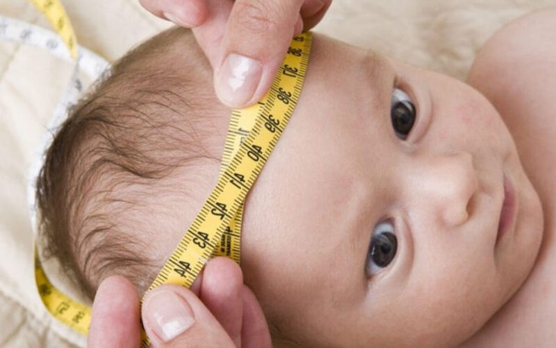 trẻ bị bẹp đầu có tròn lại được không