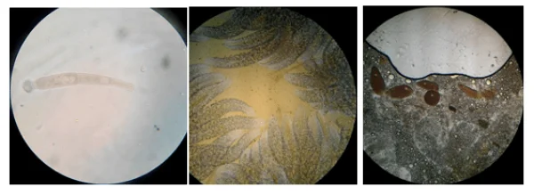 Có Nên Sục Khí Sinh Trùng Đường Ruột Cho Tôm?