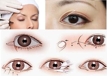 Tạo hình góc mắt trong