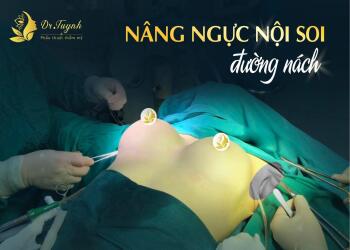 BAO NHIÊU TUỔI THÌ ĐƯỢC NÂNG NGỰC?