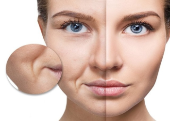 Bí quyết xóa mờ 'râu rồng' trẻ hóa khuôn mặt.