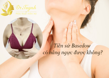 Tiền sử bệnh tuyến giáp Basedow có nâng ngực được không?