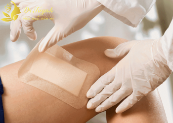 Hướng dẫn thay băng vết thương (bài chia sẻ chuyên môn với đồng nghiệp thẩm mỹ)