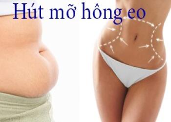 XÁC ĐỊNH VỊ TRÍ HÚT MỠ VÙNG HÔNG EO