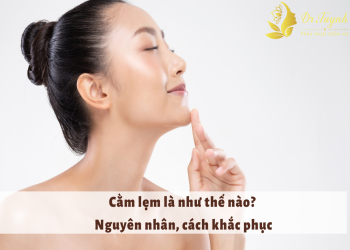 Cằm lẹm là như thế nào? Nguyên nhân, cách khắc phục