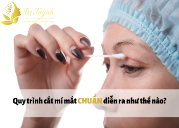 Quy trình cắt mí mắt CHUẨN diễn ra như thế nào? Chia sẻ kinh nghiệm