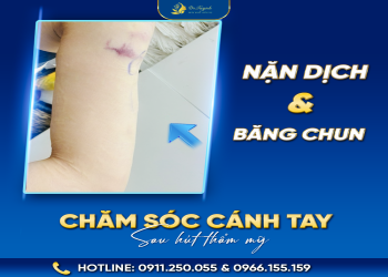 Bạn nên hút mỡ tay hay không?