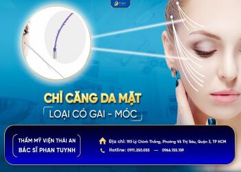 Căng da mặt bằng chỉ, chú ý phát huy ưu điểm ít sẹo