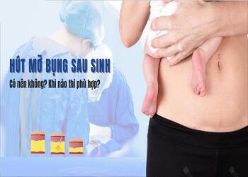 Có nên hút mỡ bụng sau sinh không?