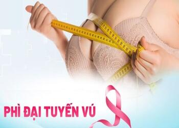 Chi phí phẫu thuật phì đại tuyến vú có đắt không?