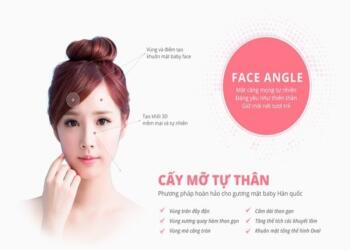 Có nên phẫu thuật mặt bằng bơm mỡ tự thân hay không?