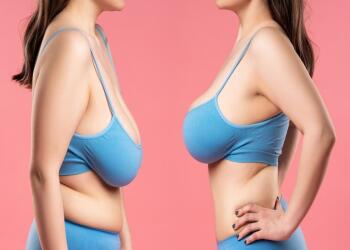 Nguyên nhân, cách khắc phục và cải thiện vòng 1 chảy xệ