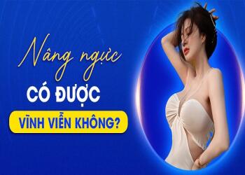 Nâng ngực có được vĩnh viễn không?