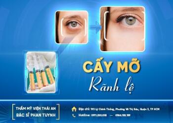 Mắt trũng sâu sau cắt mí, có áp dụng cấy mỡ tự thân được không?