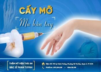 Cấy mỡ mu bàn chân