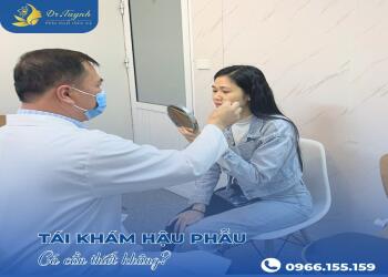 BS TUYNH Hướng dẫn bệnh nhân tự chọn dịch vụ nâng mũi cho mình