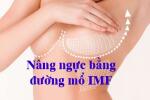 duong-mo-imf-trong-nang-nguc
