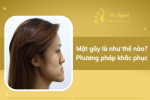mat-gay-la-nhu-the-nao-thumbnail-1