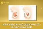 thu-nho-quang-thumbnail