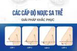 cac-cap-do-sa-tre