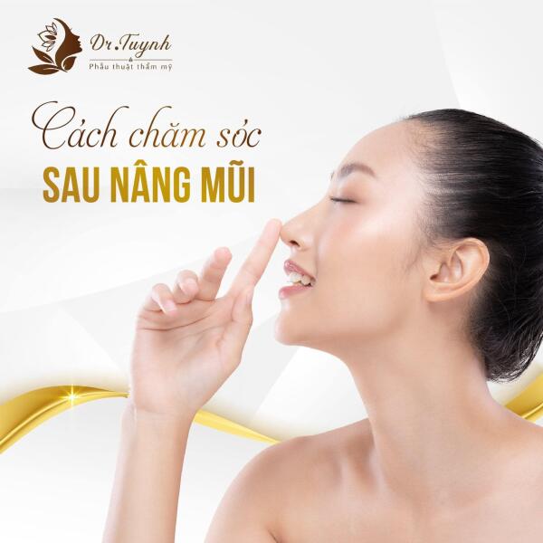 Nâng mũi chất liệu bán sinh học (Surgiform)