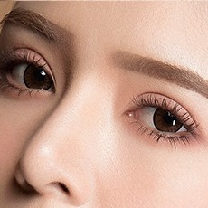 Cắt mí mắt