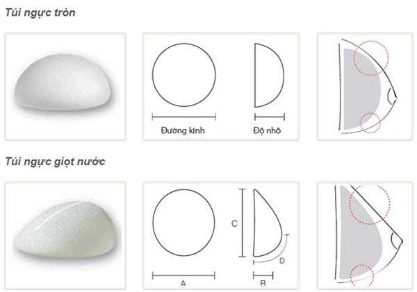 Các loại túi độn ngực hiện nay