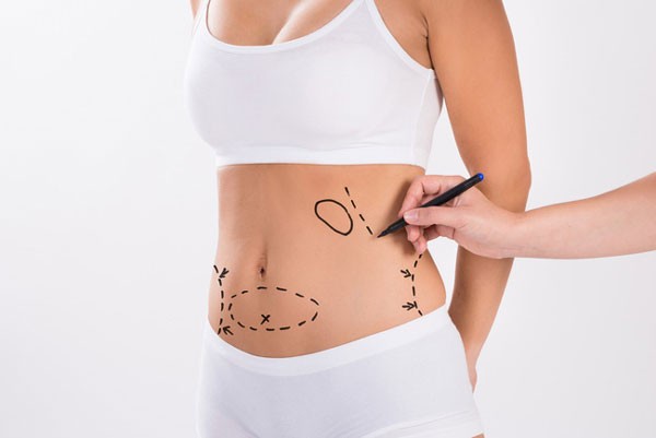 Hướng dẫn chăm sóc sau mổ tạo hình thành bụng