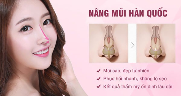 nâng mũi Hàn Quốc