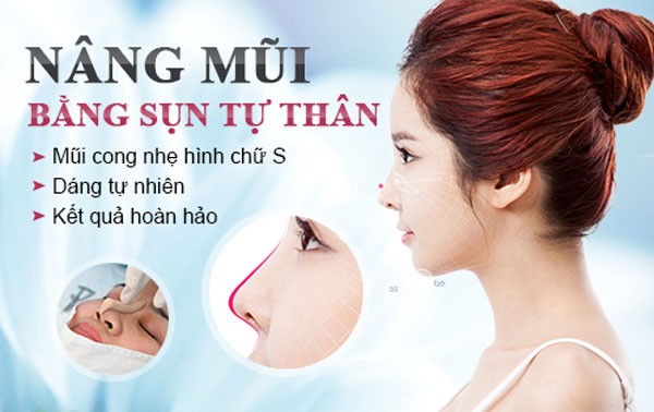 Những ưu điểm của sụn tự thân trong nâng mũi