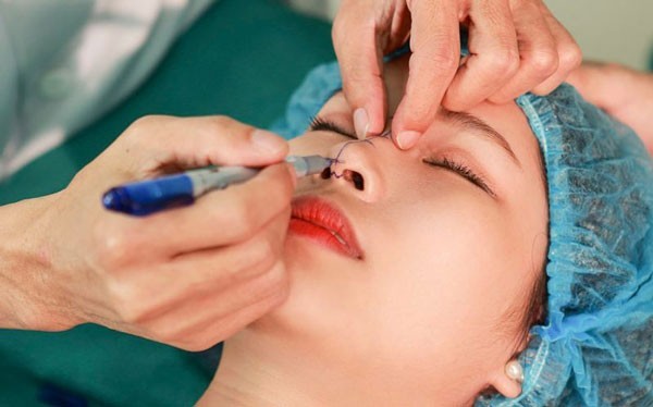 Quy trình dịch vụ phẫu thuật nâng mũi