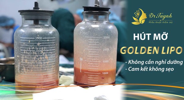 Giá tiền hút mỡ bụng 