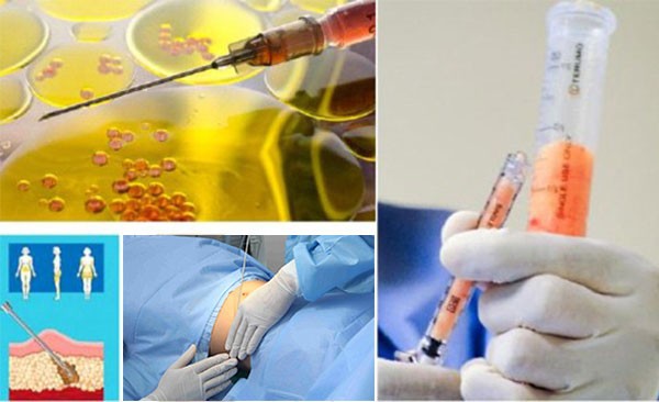 Cấy mỡ mặt duy trì được bao lâu? làm sao để có kết quả lâu dài