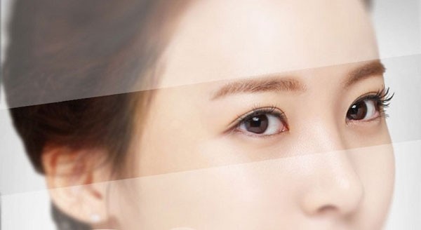 Hướng dẫn chăm sóc sau phẫu thuật treo cung mày đúng cách