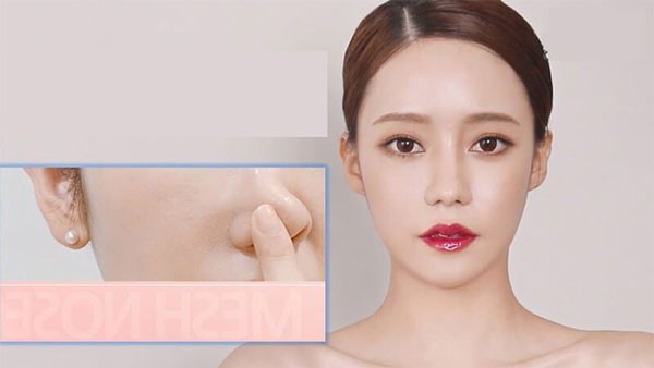 Chất liệu nâng mũi nào an toàn và hiệu quả cao nhất hiện nay?