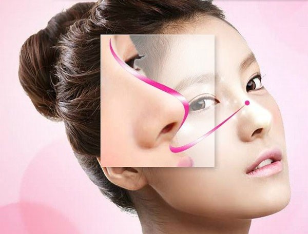 Khuôn mặt thay đổi thế nào sau khi nâng mũi