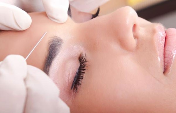 Những đối tượng nào nên áp dụng treo cung mày