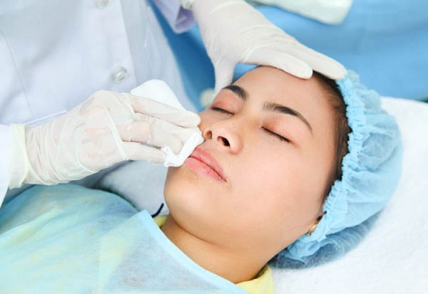 Quy trình cấy mỡ mặt diễn ra như thế nào?