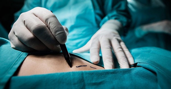 Sự quan trọng của chống nhiễm trùng trong phẫu thuật