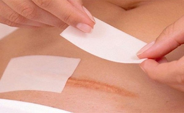 Sự quan trọng của chống nhiễm trùng trong phẫu thuật
