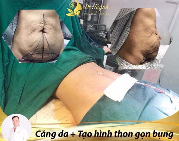  câu hỏi thường gặp trong phẫu thuật thẩm mỹ