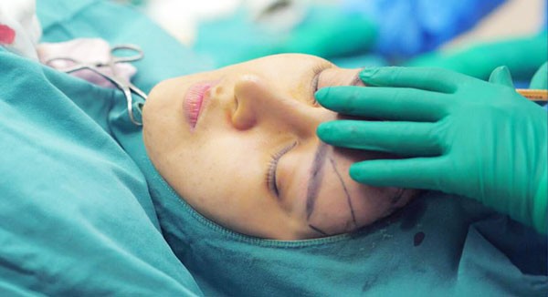 Cấy mỡ mặt có an toàn không?