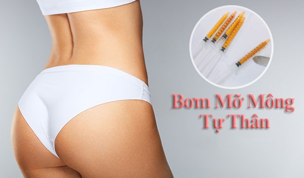 Hút mỡ bụng bơm mông 