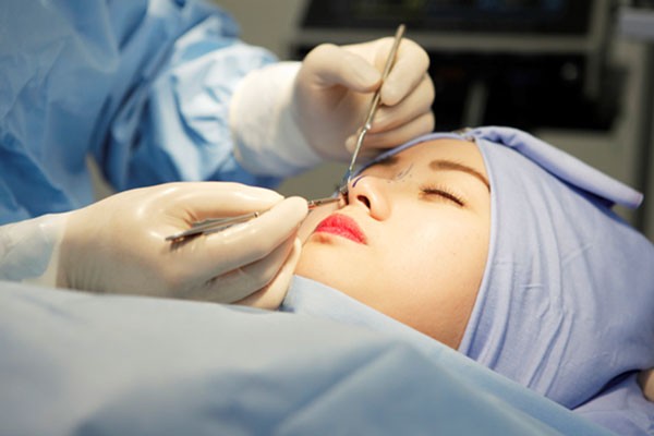 Phương pháp nâng mũi bọc sụn
