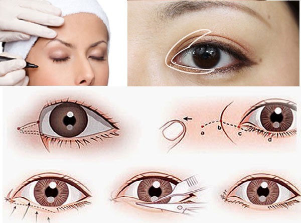Tạo hình góc mắt trong