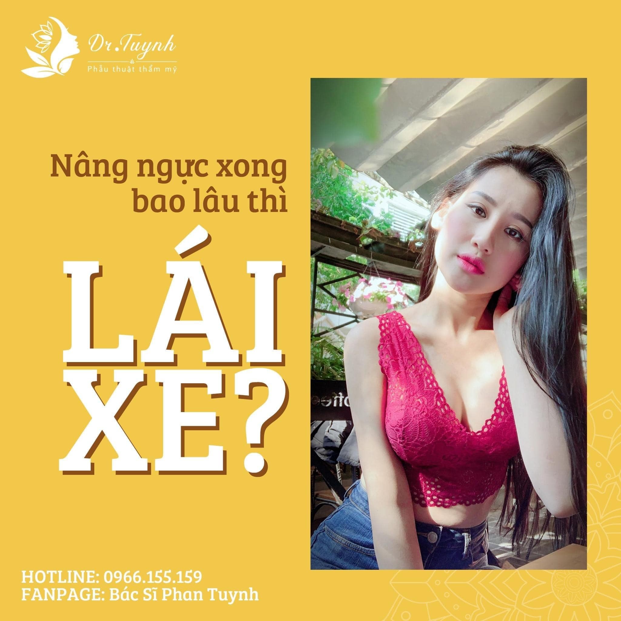 Nâng ngực bao lâu thì lái xe?