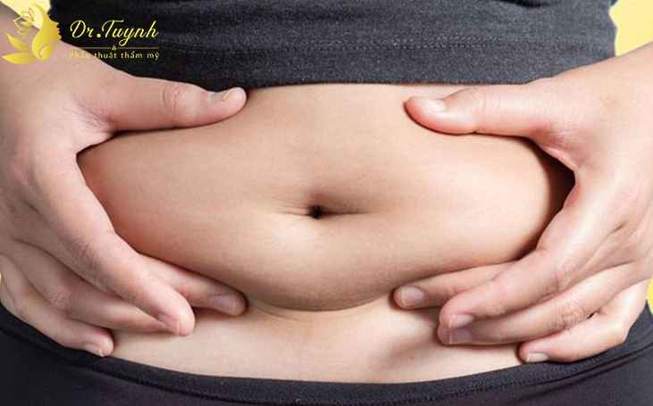 Chỉ hút mỡ bụng - không căng da tạo hình: có hiệu quả không?