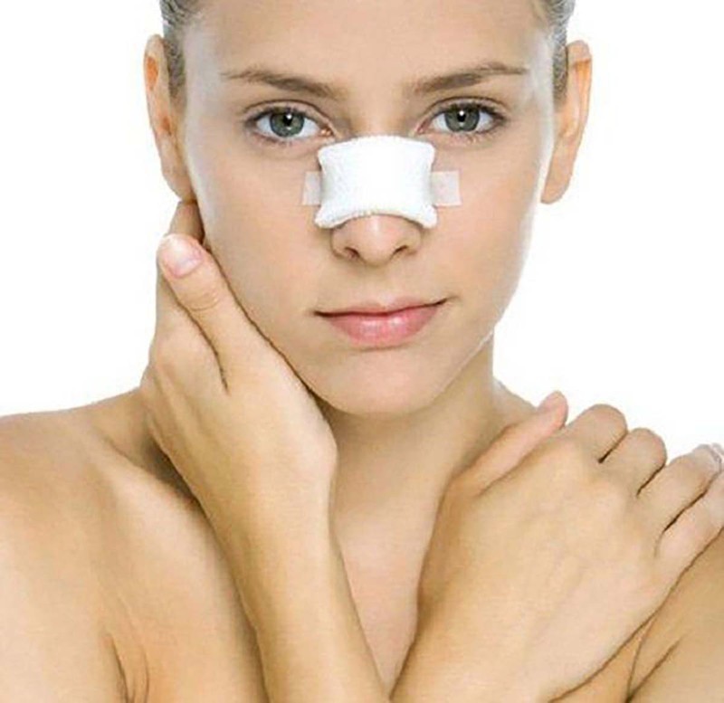 Các biến chứng thường gặp sau nâng mũi không phẫu thuật