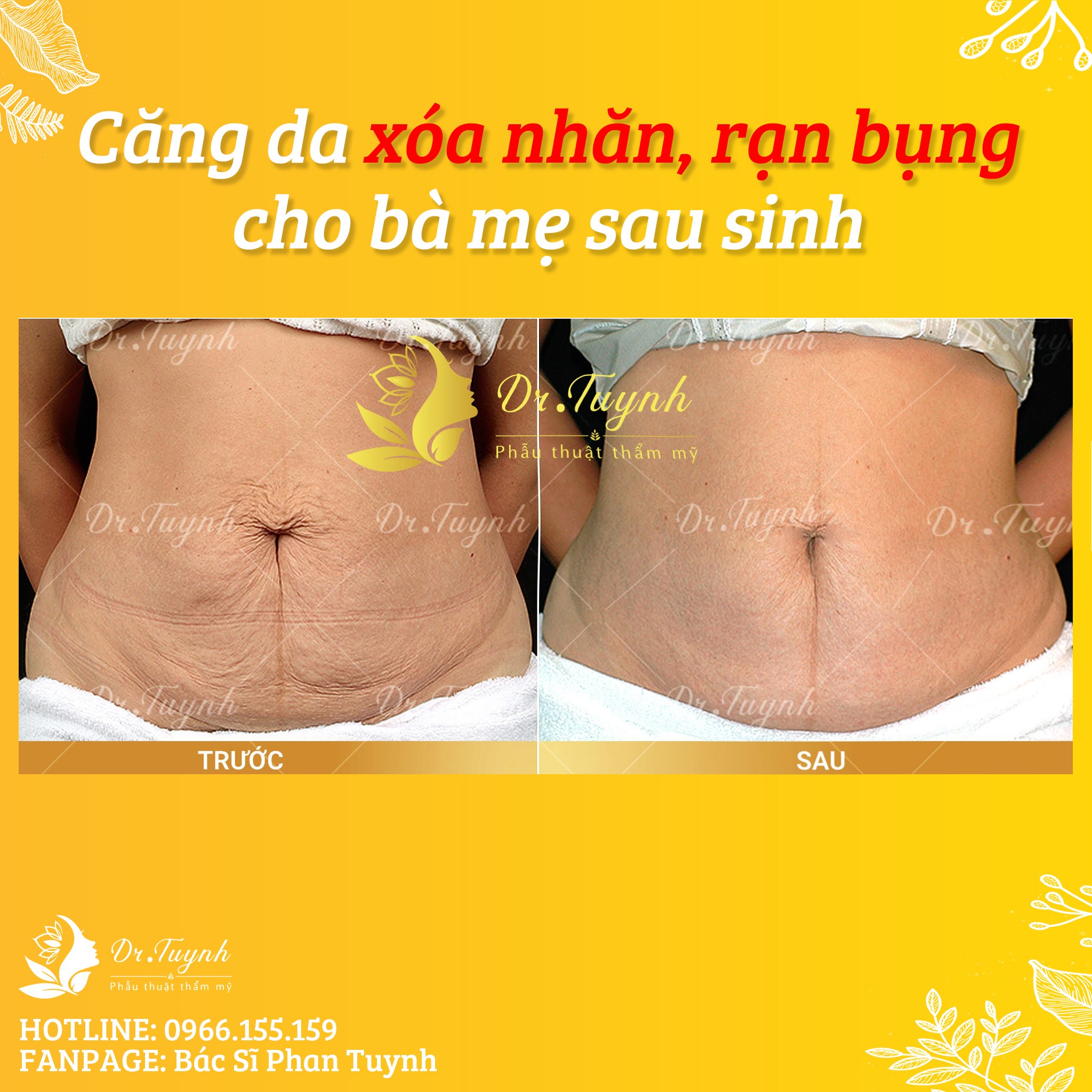 nhan-ran